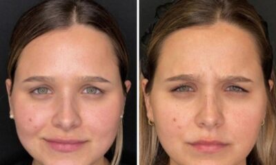 A Closer Look at Leading Anti-Age Solutions