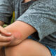 What to Put on Mosquito Bites for Fast, Steady Relief